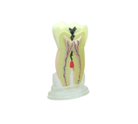 TOOTH MODEL H-TYPE - модель зуба c сагиттальным разрезом