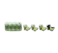 TOOTH MODEL W-TYPE - модель из 4-х зубов, демонстрирующая стадии кариеса