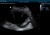 Mindray DP-50 Аппарат УЗИ Mindray DP-50 Аппарат УЗИ