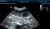 Mindray DP-30 Vet Аппарат УЗИ Mindray DP-30 Vet Аппарат УЗИ