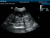 Mindray DP-50 Vet Аппарат УЗИ Mindray DP-50 Vet Аппарат УЗИ