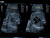 Alpinion E-cube 9 Аппарат УЗИ Alpinion E-cube 9 Аппарат УЗИ