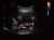 Chison Qbit 3 Аппарат УЗИ Chison Qbit 3 Аппарат УЗИ