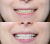 Amazing White Premium Teeth Whitening Kit 38% - набор для клинического отбеливания Amazing White Premium Teeth Whitening Kit 38% - набор для клинического отбеливания