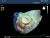 Philips iE33 Аппарат УЗИ Philips iE33 Аппарат УЗИ