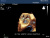 Philips iE33 Аппарат УЗИ Philips iE33 Аппарат УЗИ