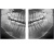 RAYSCAN Symphony Alpha SM3D – томограф 3 в 1: ортопантомограф и цефалостат 26х24 см, компьютерный томограф 3D 9х9 см RAYSCAN Symphony Alpha SM3D – томограф 3 в 1: ортопантомограф и цефалостат 26х24 см, компьютерный томограф 3D 9х9 см